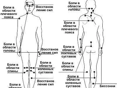 Акупунктурный точечный массаж ног, стоп, лица, тела - Медтехника №7 Москва