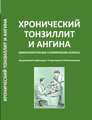 Острый тонзиллит (ангина) у взрослых - симптомы, диагностика, лечение