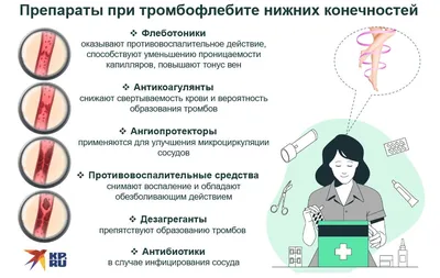 Лечение тромбоза и тромбофлебита вен нижних конечностей в Житомире -  медицинский центр Оксфорд Медикал