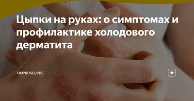 Цыпки на руках: о симптомах и профилактике холодового дерматита |  OmniusClinic | Дзен