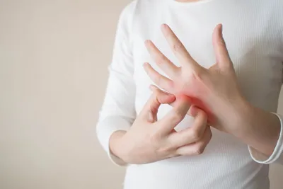 Цыпки на руках: о симптомах и профилактике холодового дерматита |  OmniusClinic | Дзен