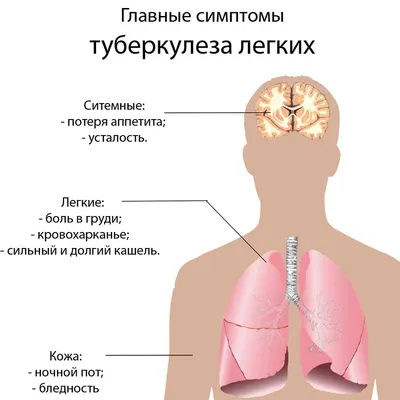Вижу новости, что простая советская «прививка от туберкулеза» защищает от  коронавируса. Это правда? — Meduza