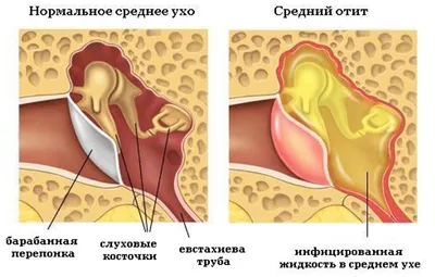 МРТ внутреннего уха в Киеве, цена на МРТ мосто-мозжечковых углов головного  мозга