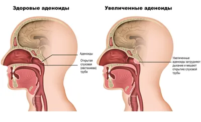 Строение уха человека - Беттертон