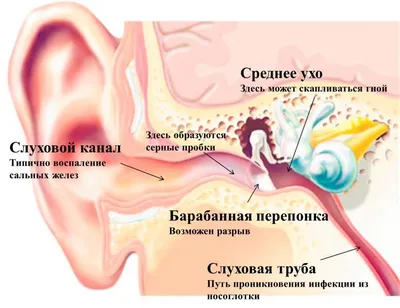 Врачи пересадили ухо, сделанное на 3D-принтере. Оно состоит из клеток  пациентки - , Sputnik Кыргызстан