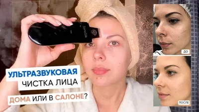 Ультразвуковая чистка лица эффективное средство омоложения!