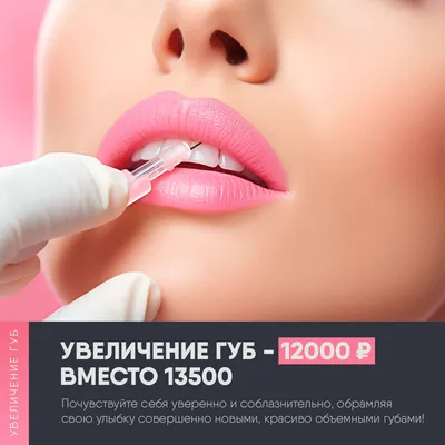 Восхитительные губы мечты с Juvederm Ultra Smile за 12000 | Медицинский  центр «Свет»