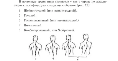 Пилатес при сколиозе - общие сведения, рекомендации, упражнения