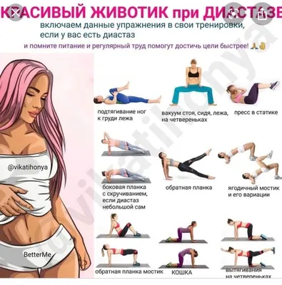 7 упражнений при диастазе | Diastasis recti exercises, Pregnancy workout,  Diastasis recti