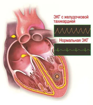 Анатомия: Сердце. Строение сердца