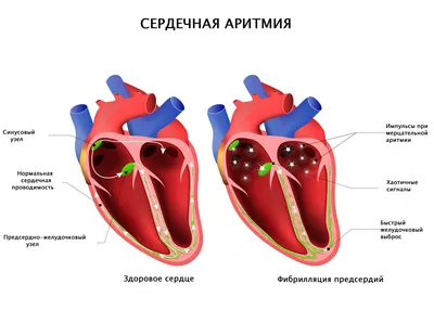 Мобильные 3D-модели сердца • Медицинский Клуб