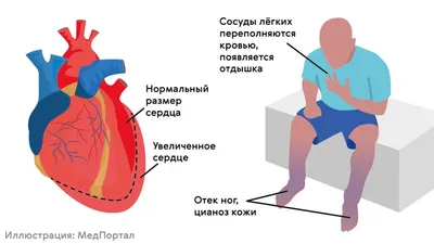 Фото и Картинки «Сердце человека»