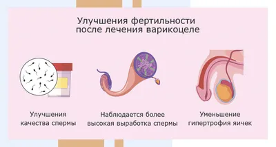 Варикоцеле у мужчин. Опасности, диагностика и лечение. Операция Мармара |  Хирург Щевцов А.Н. - YouTube