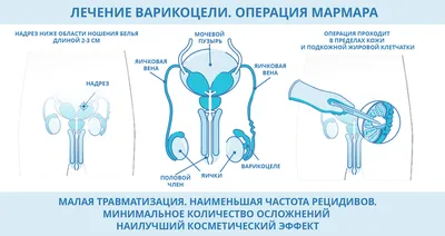 Варикоцеле и фрагментация ДНК сперматозоидов: новые доказательства с  применением в клинической практике |  — Урологический  информационный портал!