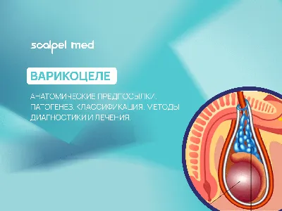 💙 󾬓 Варикоцеле 💙 󾬓 Лечение и операция по удалению варикоцеле по  доступной цене в ЗОКБ