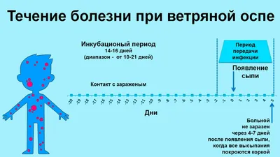 Осторожно, корь и ветрянка! Как предупредить эпидемию в компании – Кадровое  дело № 6, Июнь 2019