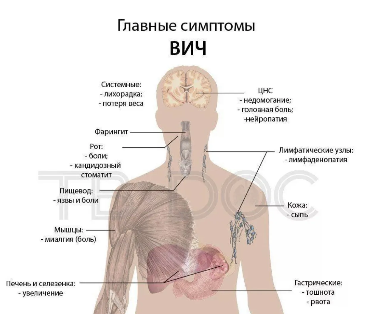 Симптомы вич картинки