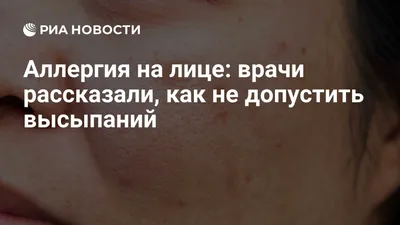 Неотложная аллергология. Виды аллергических реакций и схема лечения