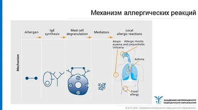 Лечение аллергии в Екатеринбурге, виды и профилактика аллергии — Семейная  Клиника