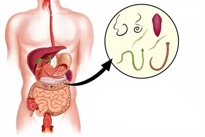 Виды глистов у человека #11