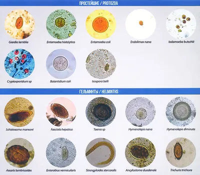 Виды глистов у человека картинки
