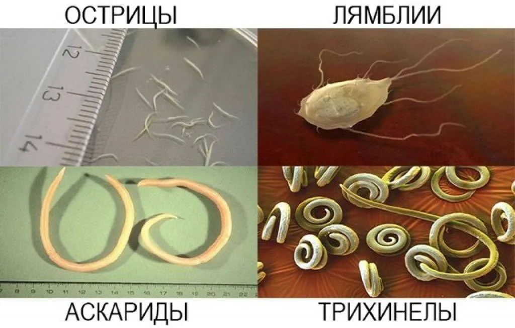 Аскарида и острица. Черви паразиты Острица. Глисты энтеробиоз острицы. Глисты аскариды у взрослых.