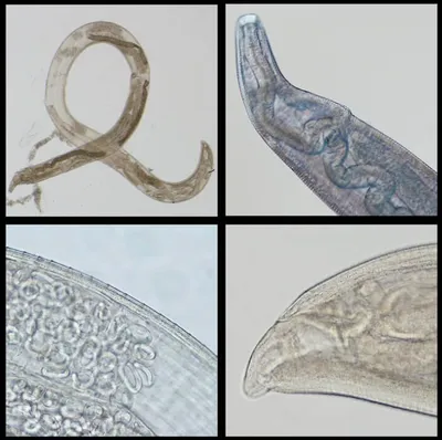 2. Фотографии маленьких глистов: Разнообразие форматов и размеров |  Маленькие глисты у человека Фото №769509 скачать