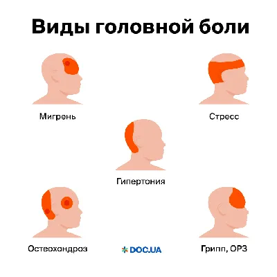 Головная боль и её виды — ГБУЗ Московской области "Долгопрудненская  больница"