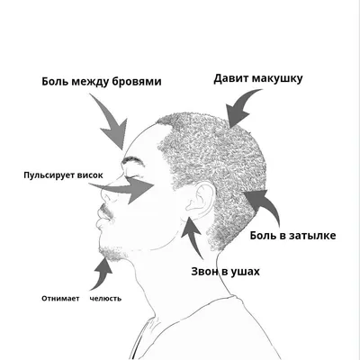 Виды головной боли - классификация и характерные симптомы