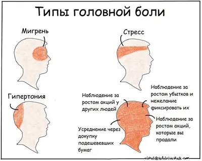 Головная боль: классификация, диагностика и лечение | Медико-генетический  центр «Геномед»