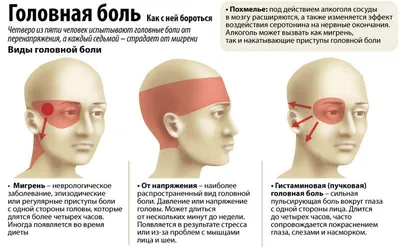 Головная Боль - Диагностика и Лечение головной боли в Киеве ✔️