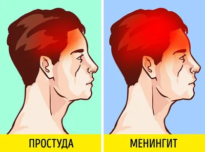 9 видов головной боли, за которыми скрываются проблемы со здоровьем / AdMe