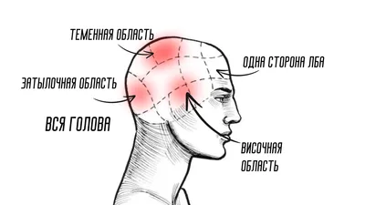Какая головная боль опасна: виды головной боли и причины. Сохраните  шпаргалку. |  | Дзен