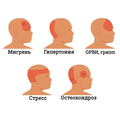 Остеопатия при головной боли - Свобода движения