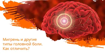 Как снять головную боль без таблеток и лекарств быстро: избавиться от головной  боли, народные средства лечения