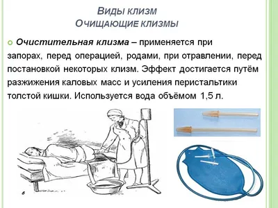 Виды клизм: назначение, постановка очистительной клизмы грудничку при  запоре, клизмы на основе масла и соли