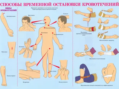 Первая помощь при кровотечениях – Администрация города Костерево