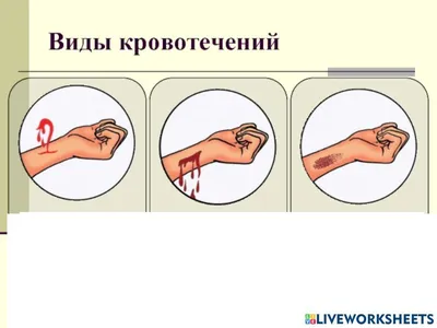 Первая помощь до оказания медицинской помощи