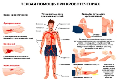 Кровотечения: виды, способы остановки - Городская детская поликлиника № 3  города Старого Оскола