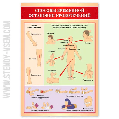 Гемостаз. Кровотечения виды кровотечения | Рефераты Уход за больными |  Docsity