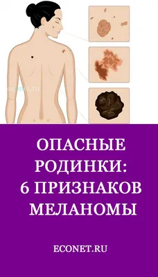 Родинки на голове: можно ли удалять? | МЦ Лазерсвiт