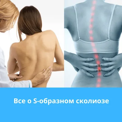 Лечение сколиоза у взрослых и детей в клинике остеопатии в Москве.