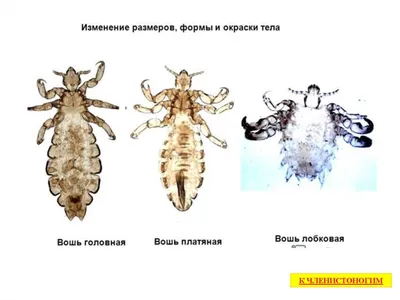 Лечение педикулеза в медицинском центре Аполлон