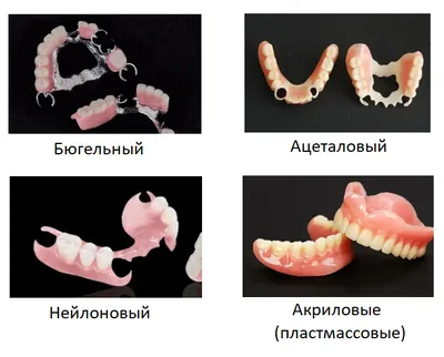 Виды зубных протезов и мостов | О ЗУБКАХ | Дзен