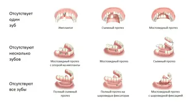 Протезирование зубов - Стоматологическая Клиника МК ДЕНТ