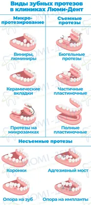 Виды протезирования зубов