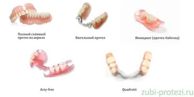 Виды зубных протезов с фото, лучшие виды протезирования зубов. Кременчуг