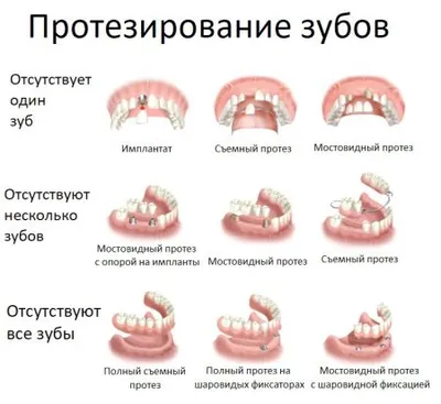 Частично съемный зубной протез на верхнюю и нижнюю челюсть, цена 9900р