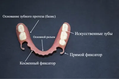 Частичные и полные пластиночные протезы, виды, этапы изготовления и цены