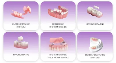 Протезирование зубов